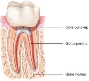 diagram of tooth