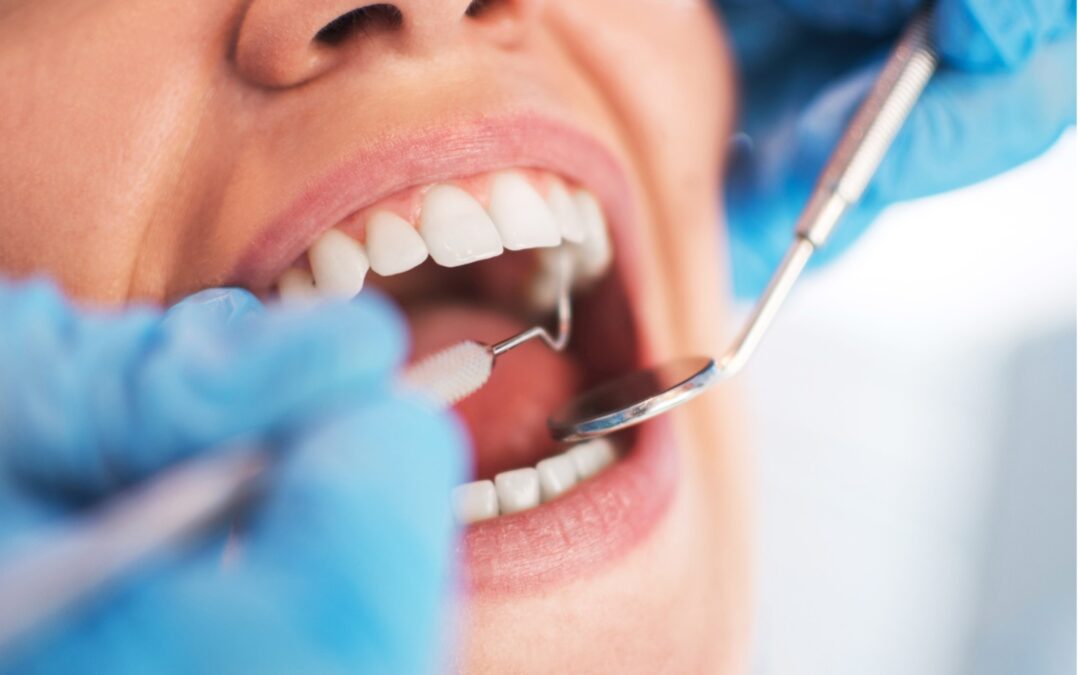 Close-up of a dentist examining a person's teeth, The Vitamins and Minerals Your Teeth Need to Stay Healthy