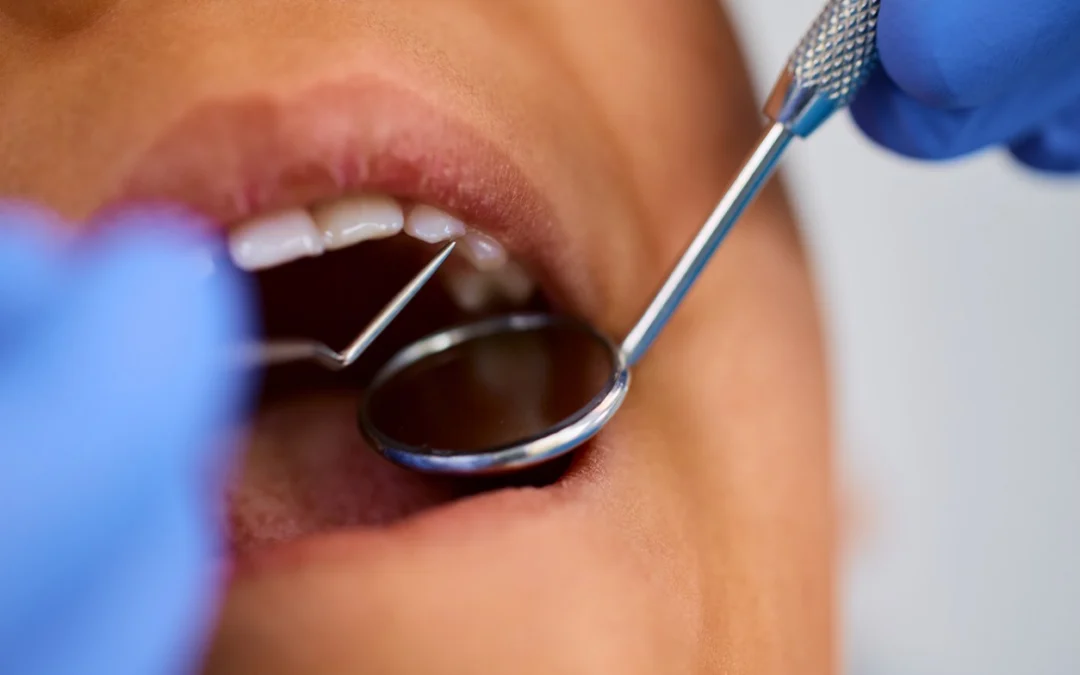Close-up of dental examination using mirror and probe